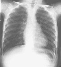 Ostéopathie, mieux comprendre l'osteopathie, les ostéopathes Ostéopathie, mieux comprendre l'osteopathie, les ostéopathes