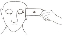 Traitement trouble obsessionnel compulsif par l’utilisation d’images spontanées Traitement trouble obsessionnel compulsif par l’utilisation d’images spontanées