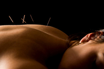 Acupuncture en rhumatologie : l'acupuncture pour quelles indications ?