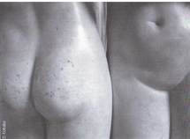 Le vaginisme ou le langage du corps. Revue Sexualites Humaines 12 Le vaginisme ou le langage du corps. Revue Sexualites Humaines 12