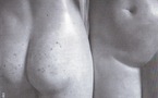 Le vaginisme ou le langage du corps. Revue Sexualites Humaines 12