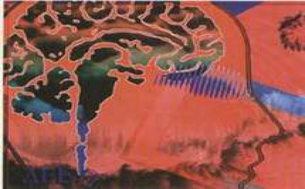 Alzheimer : Ralentir l’évolution de la maladie